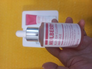 고객 업로드 사진