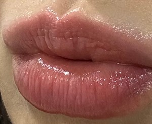 고객 업로드 사진