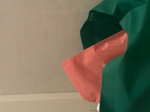 고객 업로드 사진